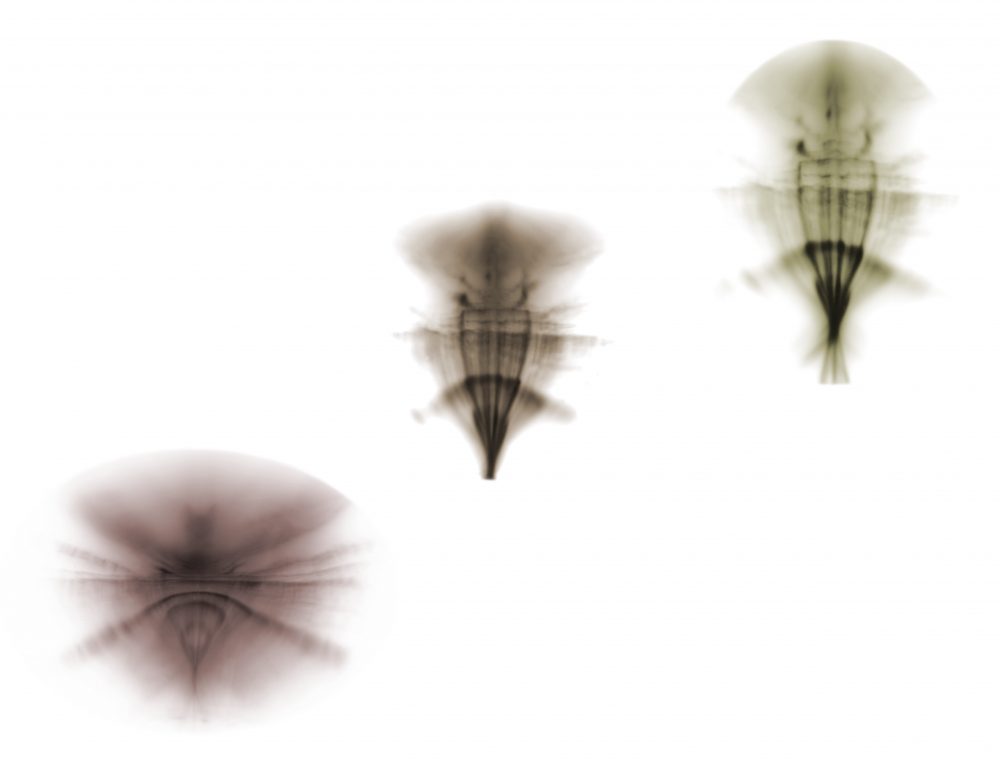 Flutter set